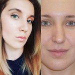 Все отзывы о Положительный отзыв Клиника пластической хирургии New me на stena-otzyvov.com